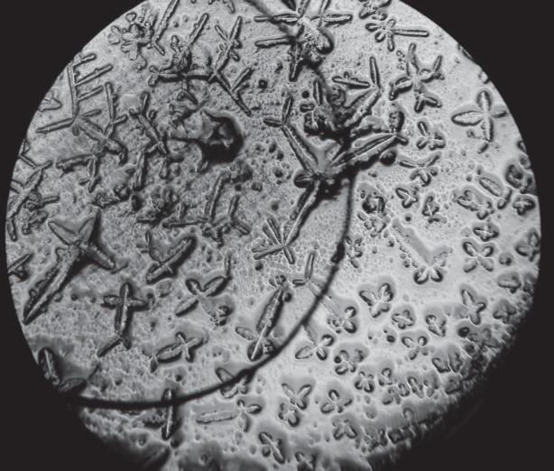 Картина кристаллизации мочи крыс при заражении T. spiralis в дозе 2000 личинок (× 60)